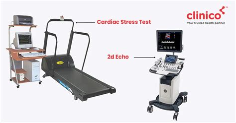 2d echo validity period|Understanding the Differences: 2D Echo vs. Stress Test (TMT).